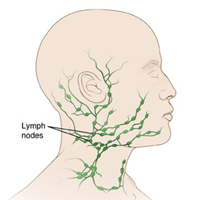 Tongue cancer treatment in Hyderabad